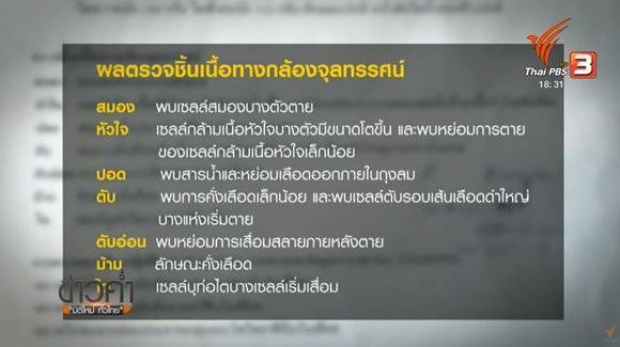 นิติเวชชี้! น้องเมย เสียชีวิตเพราะเหนื่อยหนัก ปักใจเชื่อ หัวใจไม่น่าจะหยุดเต้นเฉียบพลัน? 