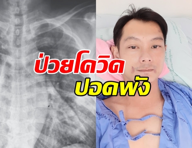 เซียนมวยป่วยโควิด! อาการหนัก ปอดพัง-พูดไม่ได้ 