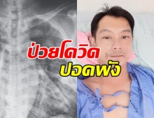 เซียนมวยป่วยโควิด! อาการหนัก ปอดพัง-พูดไม่ได้ 