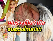 เปิดโพสต์ฉ.เต็ม ดีเจโซดา เผยสาเหตุ ผมพังยับเยิน ต้องโกนหัว-ร้องไห้ทุกวัน!