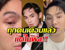 เตือนไม่ฟัง! มะตูม เจ็บหนัก หวั่นหายไม่ทันแคสงานที่เกาหลี