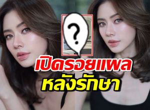 เปิดภาพล่าสุด เอ๋ พรทิพย์ เห็นรอยแผลชัด หลังผ่าตัดมะเร็ง