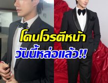 โจรส่งสารจากเรือนจำ ขอโทษพระเอกดัง ใช้ไม้เบสบอลตีหน้า