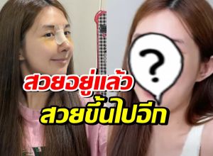เปิดหน้าล่าสุด เบียร์ เดอะวอยซ์ หลังทำจมูก14วัน นึกว่าสาวเกาหลี