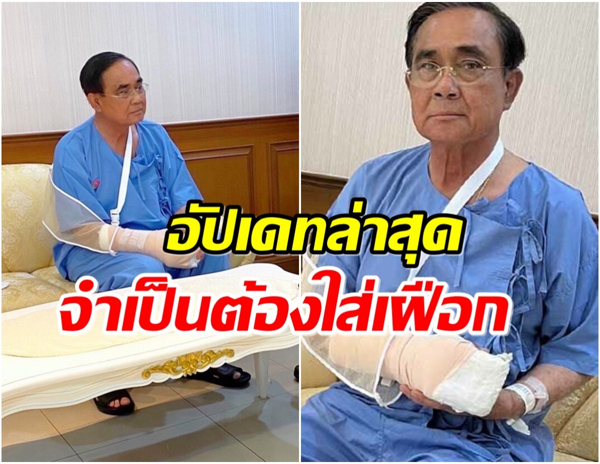 เปิดภาพ ประยุทธ์ มือขวาบวมต้องใส่เฝือก นอนพักรพ.