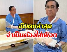 เปิดภาพ ประยุทธ์ มือขวาบวมต้องใส่เฝือก นอนพักรพ.