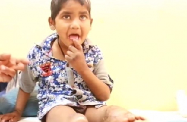 เด็กอินเดียแทะนิ้วมือตัวเอง จนเลือดโชก แพทย์ชี้ป่วยภาวะไม่รู้สึกตัว