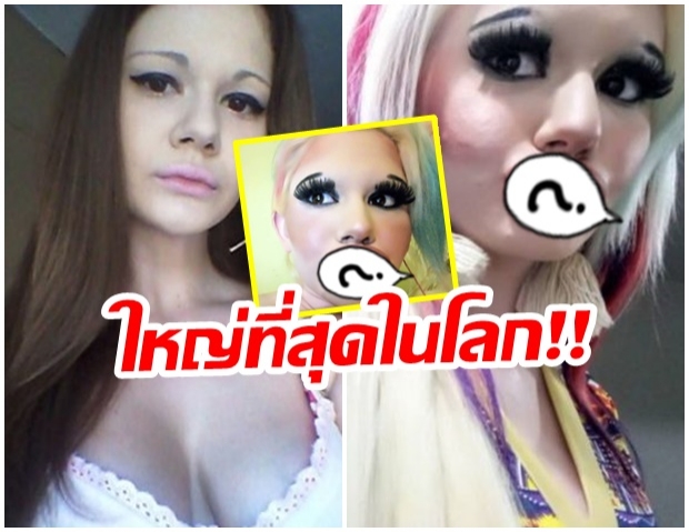 ตั้งเป้าสถิติปากใหญ่ที่สุดในโลก สาวบัลแกเรียฉีดฟิลเลอร์ 15 ครั้ง