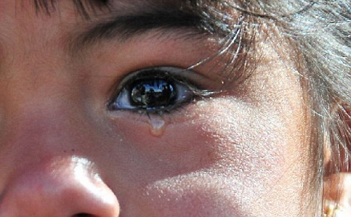 แพทย์ภารตะตะลึง เด็กหญิงเจ็ดขวบร้องไห้เม็ดหินออกจากน้ำตา