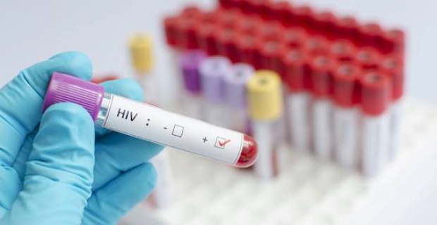 แพทย์อังกฤษ รักษาผู้ติดเชื้อ HIV หายขาดรายที่ 2 ของโลก