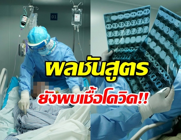 ผลชันสูตรพบ เชื้อโควิด-19 ยังอยู่ในร่างผู้ป่วย!!