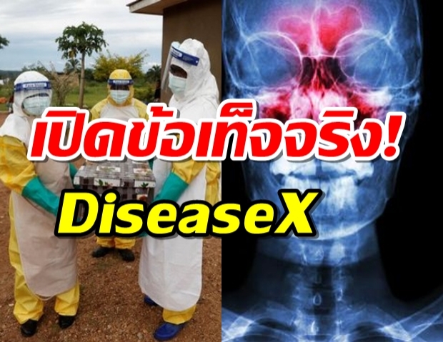 เปิดข้อเท็จจริง! Disease X ไม่ใช่โรคใหม่ 