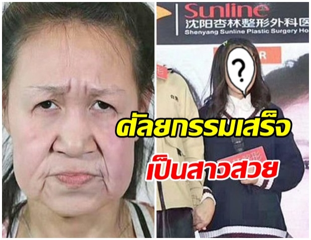 สาวน้อยป่วย “โรคหน้าแก่” เผยโฉมใหม่ชวนตะลึง หลังคนใจบุญแห่บริจาคค่าศัลยกรรม