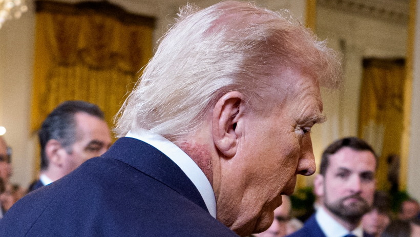 โซเชียลแห่แชร์ ทรัมป์เป็นโรคอะไร?มีแผลผื่นแดงหนารอบลำคอ