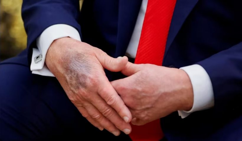 เกิดอะไรขึ้น?จับพิรุธ ทรัมป์พูดไม่รู้เรื่อง-ก้าวร้าวผิดปกติ!