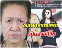 สาวน้อยป่วย “โรคหน้าแก่” เผยโฉมใหม่ชวนตะลึง หลังคนใจบุญแห่บริจาคค่าศัลยกรรม