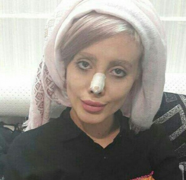 เงิบทั่วโลก!! สาวอิหร่าน รับแล้ว โกหกศัลยกรรมหน้า50หนเลียนแบบ‘โจลี่’