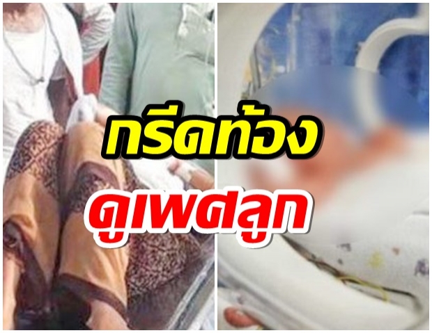 สุดสลด! สามี ผ่าท้องเมีย ลั่นอยากรู้เพศลูก-เด็กเสียชีวิตทันที 