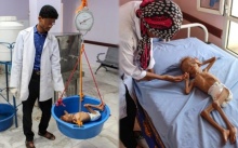 สุดสลด!! สงครามเยเมนทำข้าวของแพง เด็ก 5 ล้านคน ประสบภาวะอดอาหาร