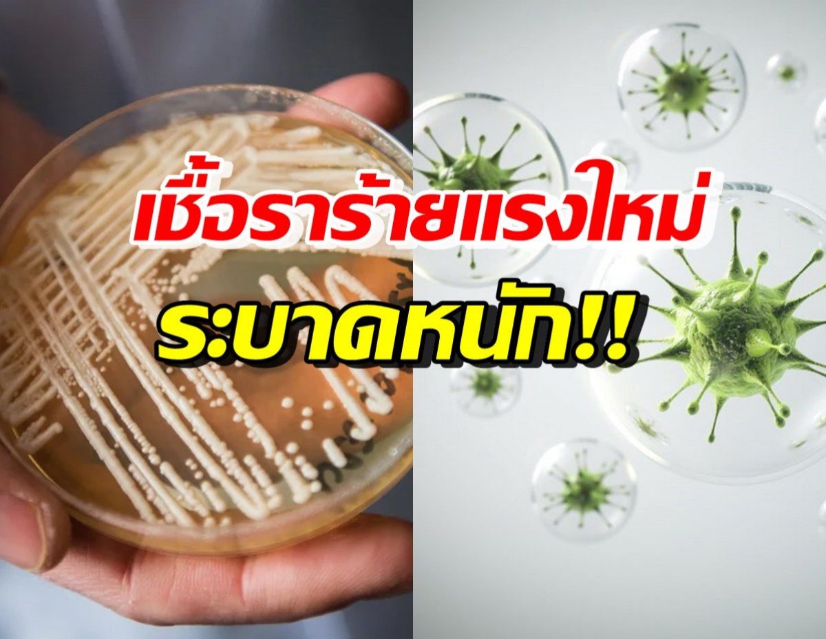 สหรัฐฯ ผวา เชื้อราเกิดขึ้นใหม่ “Candida auris” ระบาดหนัก!!